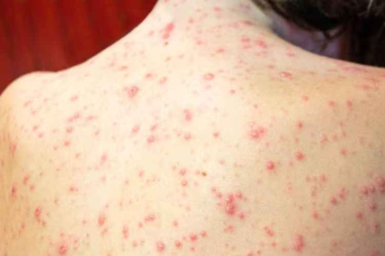 प्रातिनिधिक फोटो